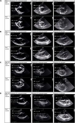 Brief Report: Case Comparison of Therapy With the Histone Deacetylase Inhibitor Vorinostat in a Neonatal Calf Model of Pulmonary Hypertension